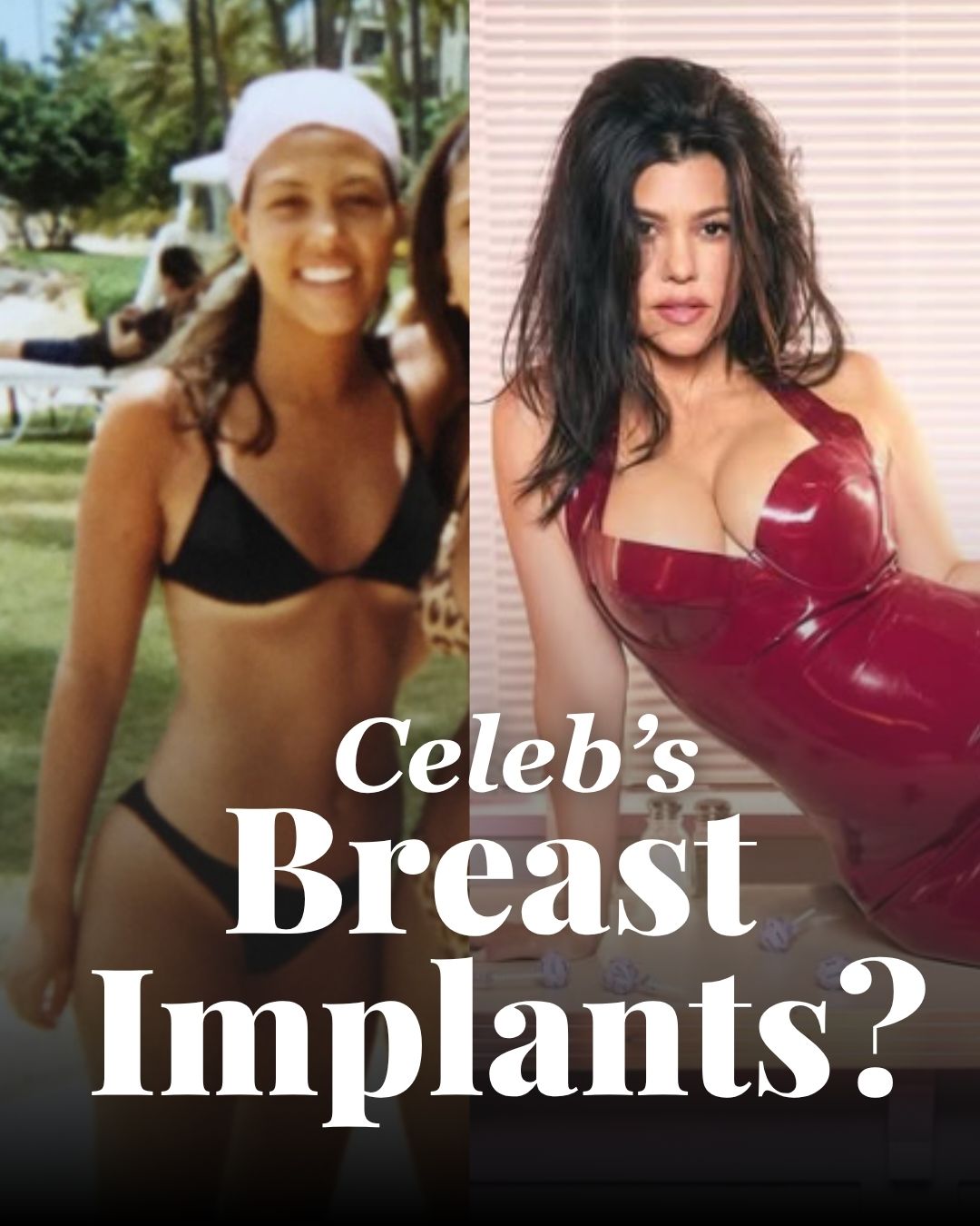 celebrity-breast-implants-tijuana