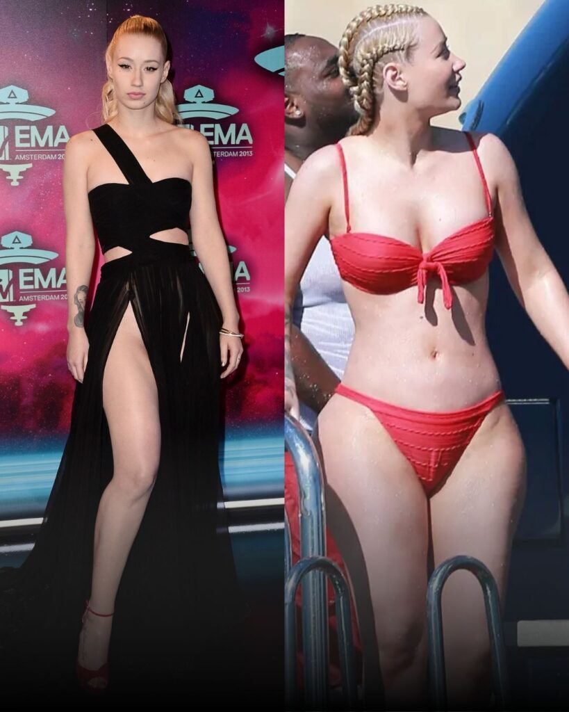 celebrity-breast-implants-tijuana