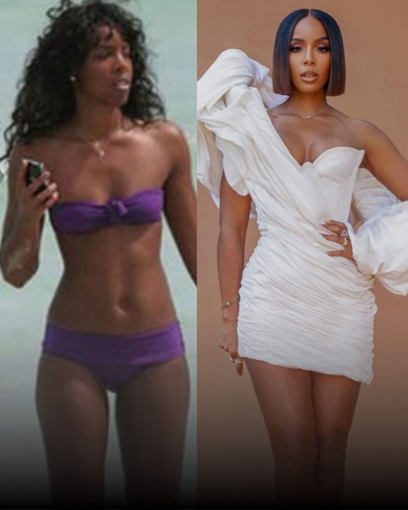 celebrity-breast-implants-tijuana