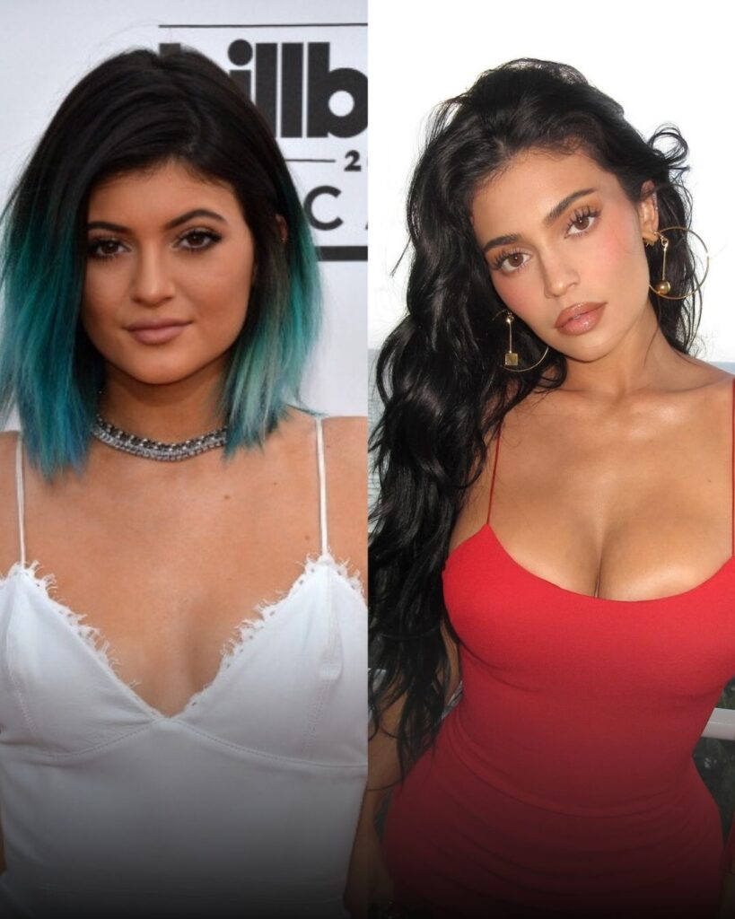 celebrity-breast-implants-tijuana