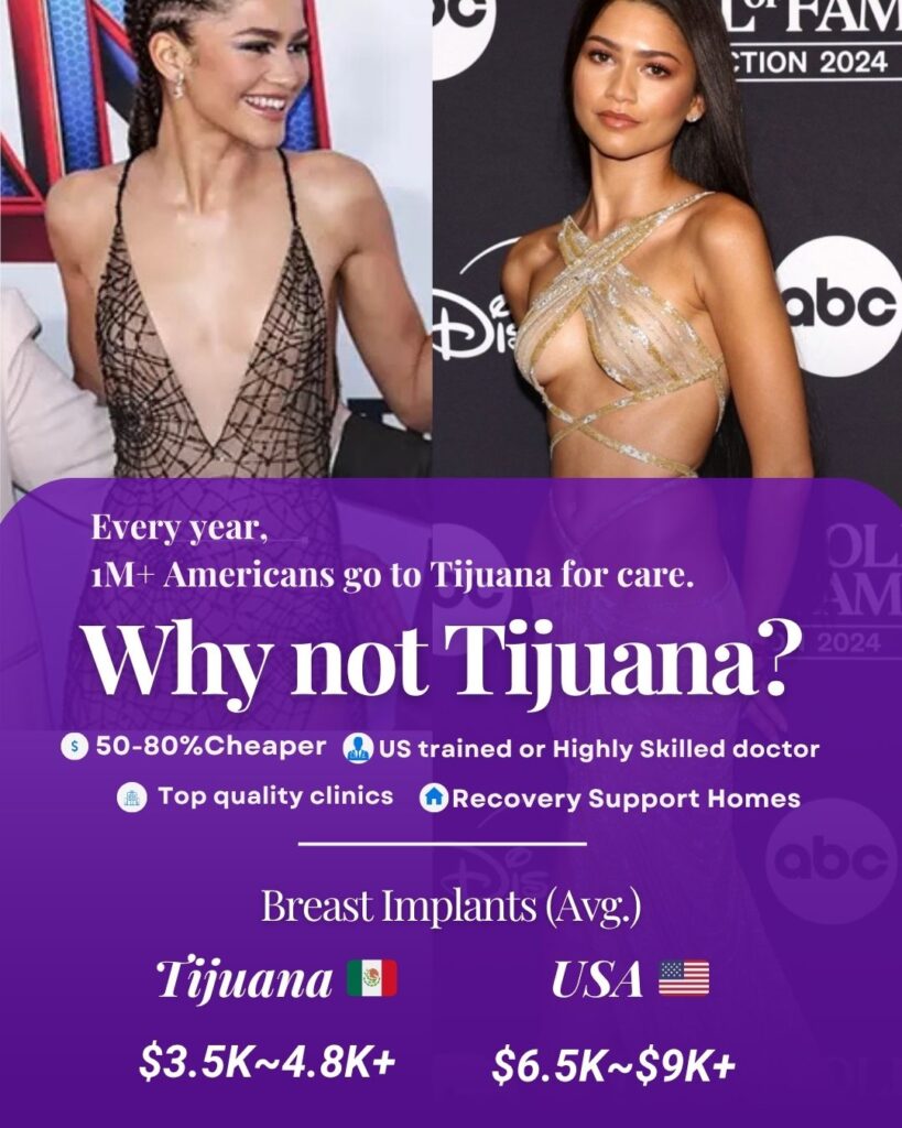 celebrity-breast-implants-tijuana